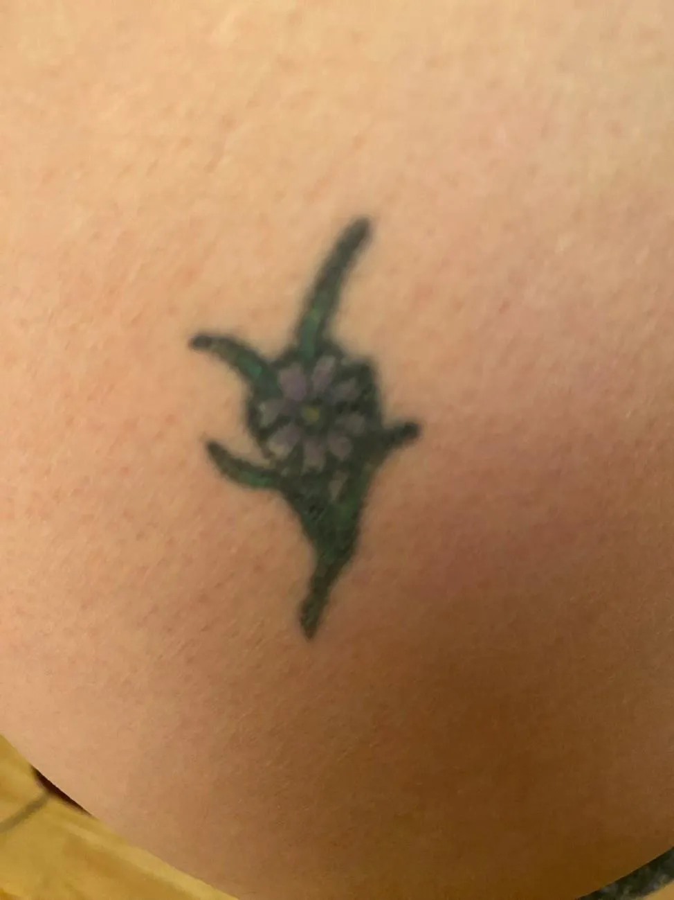Where it Started — Why do you have plankton on your butt?